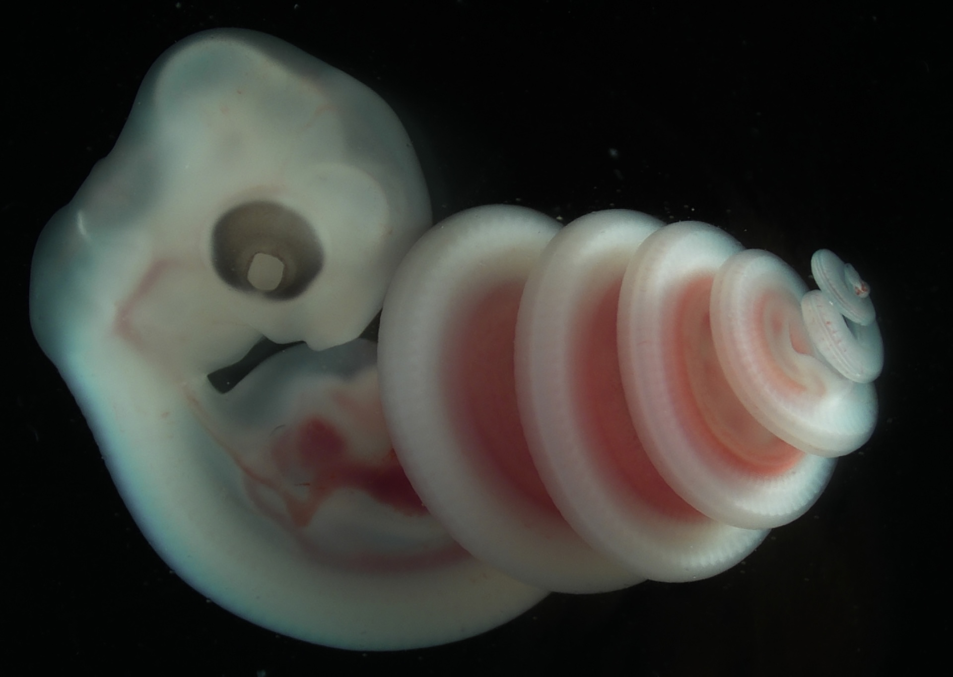 A developmental puzzle: why snakes coil in the same direction.