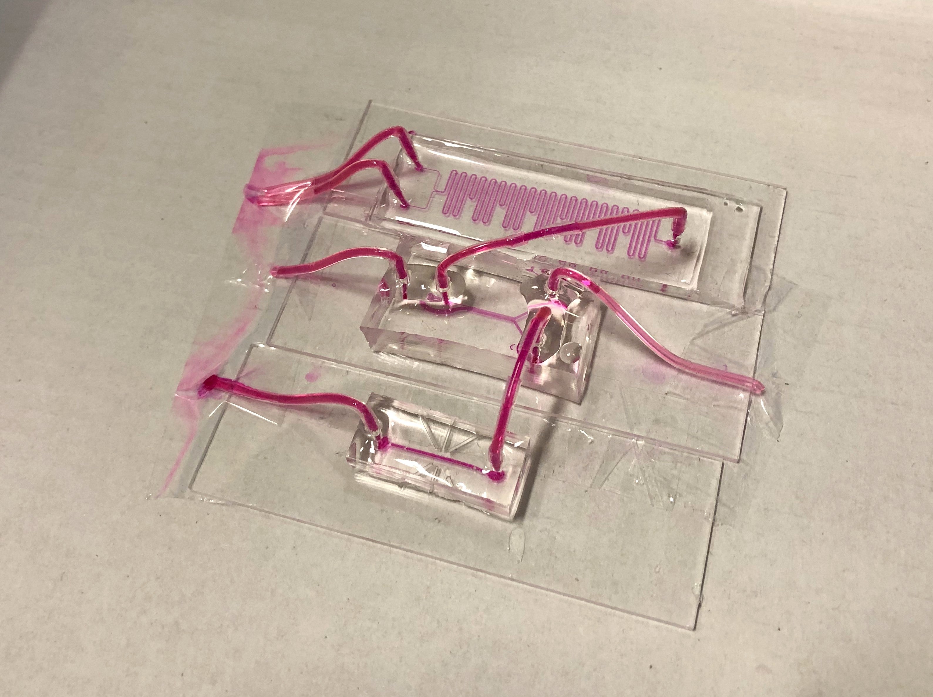 New monitoring technology could help identify more donor lungs for transplantation